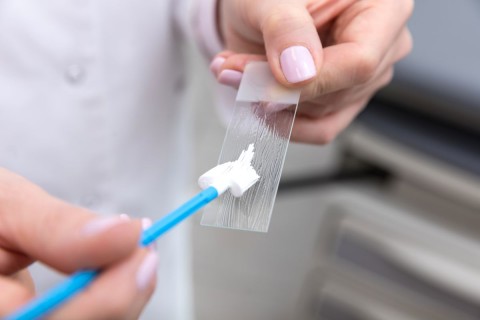Consultatie medicala + set analize ginecologice la doar 299 lei !