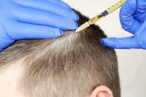 PRP Scalp 499 Ron/sedinta!